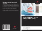 Central incisors at the center of the smile