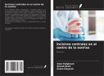 Incisivos centrales en el centro de la sonrisa
