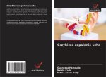 Grzybicze zapalenie ucha