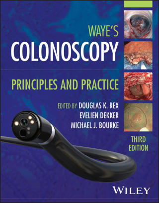 Colonoscopy