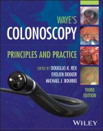 Colonoscopy
