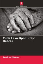 Cutis Laxa tipo II (tipo Debre)