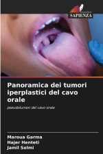 Panoramica dei tumori iperplastici del cavo orale