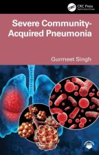 Severe Community Acquired Pneumonia