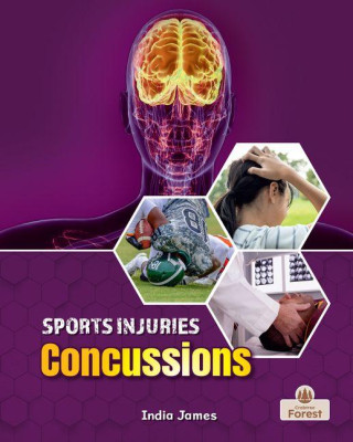 Concussions