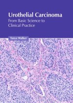 Urothelial Carcinoma: From Basic Science to Clinical Practice