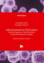 Advancements in Oral Cancer - Modern Diagnostics, Altered Molecular Profile and Therapeutic Strategies