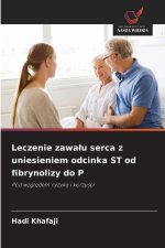 Leczenie zawa¿u serca z uniesieniem odcinka ST od fibrynolizy do P