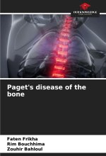 Paget's disease of the bone