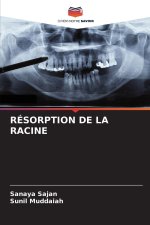 RÉSORPTION DE LA RACINE