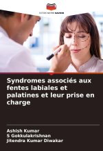 Syndromes associés aux fentes labiales et palatines et leur prise en charge