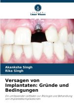 Versagen von Implantaten: Gründe und Bedingungen