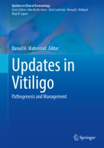 Updates in Vitiligo