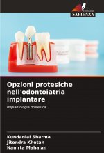 Opzioni protesiche nell'odontoiatria implantare
