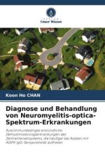 Diagnose und Behandlung von Neuromyelitis-optica-Spektrum-Erkrankungen
