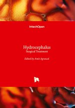 Hydrocephalus - Surgical Treatment