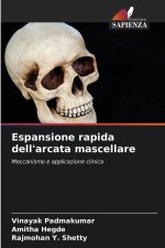 Espansione rapida dell'arcata mascellare