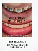 Mastering Smile Design