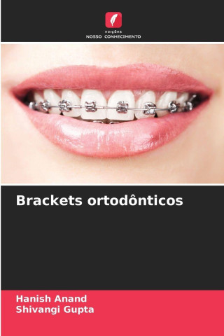 Brackets ortodônticos
