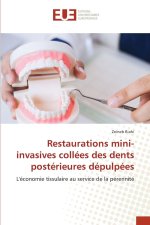 Restaurations mini-invasives collées des dents postérieures dépulpées
