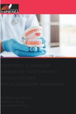 RIDEFINIRE IL SORRISO: OPZIONI DI TRATTAMENTO DELL'ECCESSIVA VISUALIZZAZIONE GENGIVALE