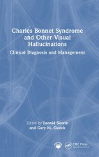 Charles Bonnet Syndrome and Other Visual Hallucinations