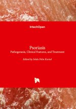 Psoriasis - Pathogenesis, Clinical Features, and Treatment