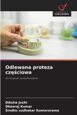 Odlewana proteza cz¿¿ciowa