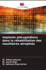 Implants ptérygoïdiens dans la réhabilitation des maxillaires atrophiés