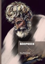 Biopsies