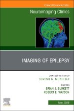 Imaging of Epilepsy, An Issue of Neuroimaging Clinics of North America