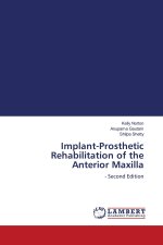 Implant-Prosthetic Rehabilitation of the Anterior Maxilla