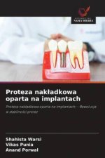 Proteza nak¿adkowa oparta na implantach