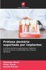 Prótese dentária suportada por implantes