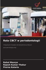 Rola CBCT w periodontologii