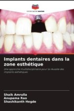 Implants dentaires dans la zone esthétique