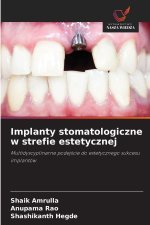 Implanty stomatologiczne w strefie estetycznej