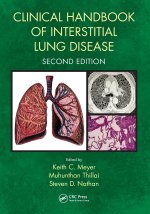 Clinical Handbook of Interstitial Lung Disease