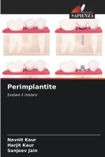 Perimplantite