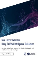 Skin Cancer Detection Using Artificial Intelligence Techniques
