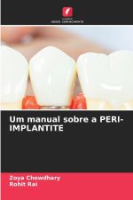 Um manual sobre a PERI-IMPLANTITE