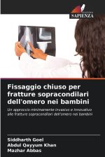 Fissaggio chiuso per fratture sopracondilari dell'omero nei bambini