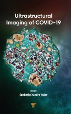 Ultrastructural Imaging of COVID-19