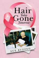 Hair Today Gone Tomorrow