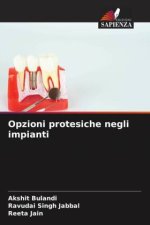 Opzioni protesiche negli impianti