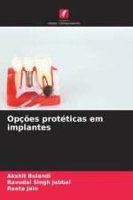 Opções protéticas em implantes