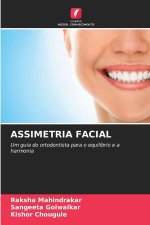 ASSIMETRIA FACIAL