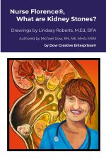 Nurse Florence®, What are Kidney Stones?