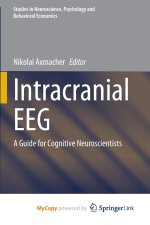 Intracranial EEG