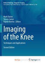 Imaging of the Knee
